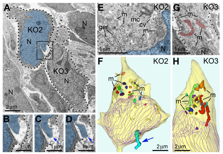 Adjacent herniated and non-herniated neurons show distinct ultrastructural characteristics of mitochondria. (A) Two neurons from the intermediate zone of CB1R−/− embryo indicated as cell numbers KO2 and KO3 (dotted lines designate their plasma membranes). Cell KO2 exhibits PNH, whereas KO3 shows an intact nucleus. (B–D) Serial images of PNH from the framed area in (A). The chromatin stream (blue arrows) herniated from the nucleus (highlighted blue) penetrates the intercellular space. (E–H) High-power images (E,G) and 3D reconstructions (F,H) of the cells KO2 and KO3. Twenty randomly selected mitochondria from each cell are shown in different colors in the 3D reconstructions. Cell KO2 exposing PNH (blue arrow) contains mostly short or spherical mitochondria, whereas several mitochondria from cell KO3 are long. Nuclei profiles are traced violet. Abbreviations: cv, cilial vesicle; ger, granular endoplasmic reticulum; m, mitochondria, mc, mother centriole; N, nucleus. Modified from [53]. (License CC BY).