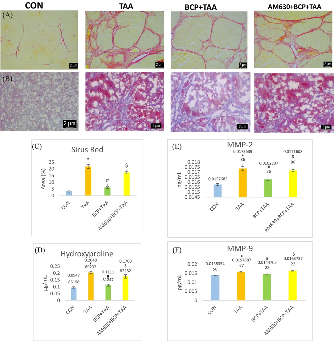 (A) Pirosirius Red liver staining. (B) Oil Red O staining. (C) Quantification of Pirosirius Red staining. (D) Hydroxyproline level in serum. Enzyme level of (E) MMP2 and (F) MMP9 (n = 7–8) in liver tissue. *p < 0.05 CON vs. TAA, # p < 0.05 TAA vs. BCP + TAA, $ p < 0.05 BCP + TAA vs. AM630 + BCP + TAA (one‐way ANOVA followed by DMRT). CON: Control, BCP + TAA: β‐Caryophyllene+ Thioacetamide treatment, AM630 + BCP + TAA: AM630+ β‐Caryophyllene+ Thioacetamide.