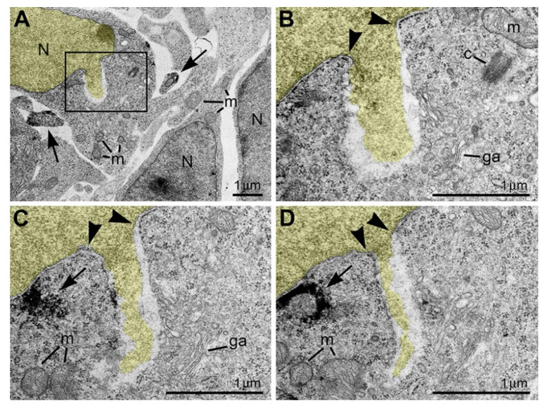 NE rupture in a neuron from the cortical plate of wild-type mouse embryo exposed to CB1R agonist CP-55940. (A) Low-power micrograph shows ultrastructure of neuronal cell bodies and neuropil that is generally normal for the developmental stage. (B–D) Serial high-power images of NE rupture from the framed area in (A). Chromatin stream expelled from the nucleus (highlighted yellow) is not surrounded by the nuclear membrane. A complete series of 12 ultrathin sections show that the chromatin stream stays in cytoplasm. Arrowheads indicate points of interruption of the nuclear membrane. Arrows point to CB1R-positive axons in (A) and CB1R-positive intracellular vesicle in (C,D). Abbreviations: c, centriole; ga, Golgi apparatus; m, mitochondria; N, nucleus. Modified from [53]. (License CC BY).