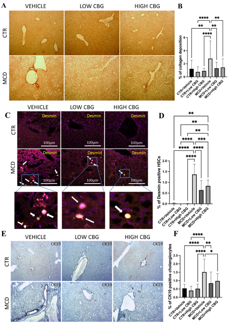 An evaluation of liver fibrosis and ductular proliferation. (A) Picrosirius red staining shows collagen deposited in FFPE liver sections. Red intensity represents the deposited collagens indicative of fibrotic liver tissue scars. Original magnification ×100. (B) The quantification of the level of fibrosis. (C) Illustrative pictures depicting desmin immunofluorescence staining on liver sections from mice in each experimental group. White arrows indicate the overlap of DAPI (violet) and desmin (yellow). Original magnification ×200. (D) The quantification of the level of desmin-positive HSCs. (E) Representative images of the immunohistochemistry staining of CK-19 (brown) positive cholangiocytes of the liver sections from mice of each group. Original magnification ×100. (F) The quantification of CK-19-positive cholangiocytes. * p < 0.05; ** p < 0.01; *** p < 0.001; **** p < 0.0001. Quantification is completed using ImageJ software.