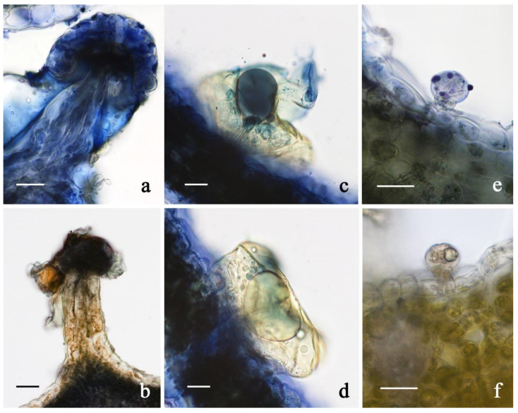 LM micrographs showing the results of the histochemical investigation on the glandular trichomes in the investigated C. sativa varieties. (a,b) Capitate-stalked trichome: Nadi reagent (a), Ferric Tricloride (b); (c,d) capitate-sessile trichome: Nadi reagent; (e,f) bulbous trichome: Nadi reagent (e), Ferric Tricloride (f). Scale bars = 20 µm.