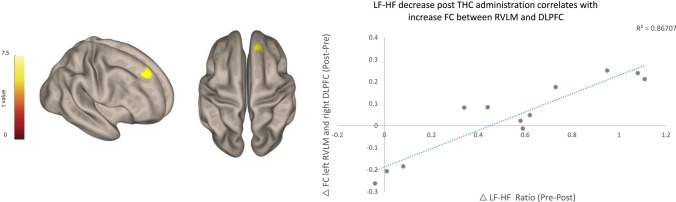 LF-HF ratio decrease post THC administration correlates with an increase in functional connectivity between RVLM and DLPFC. Seed-to-whole-brain functional connectivity regression analysis was performed with left RVLM ROI (− 5, − 42, − 52, 2 mm) 30. Increased functional connectivity was found between RVLM and right DLPFC correlated with LF-HF ratio reduction after THC administration. Right DLPFC, MNI coordinates 18 38 38; 145 voxels, T(10) = 6.4, cluster p-FDR = 0.000071. DLPFC dorsolateral prefrontal cortex, FDR false discovery rate, HF high frequency, LF low frequency, MNI Montreal Neurological Institute, ROI region of interest RVLM rostral ventrolateral medulla, THC δ-9-tetrahydrocannabinol