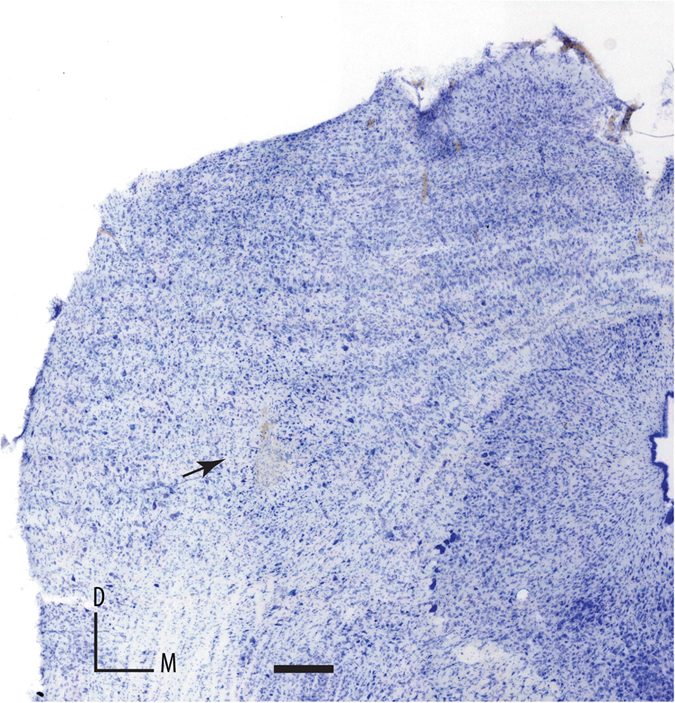 Photomicrograph of a coronal section through the rostral cortex of the IC showing a typical electrolytic lesion of a recording site for a neuron with a high CSI value. Scale bar, 1 mm. M, medial; D, dorsal.