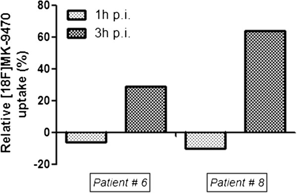 Relative binding of 18F-MK-9470 in lesions of the appendicular skeleton 1 and 3 h p.i. Uptake of 18F-MK-9470 was increased with 29% (6) and 64% (8) in two metastases of the appendicular skeleton 3 h p.i.