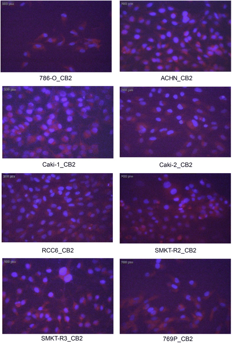 Immunocytochemical (ICC) staining of cannabinoid receptors. ICC was used to stain the CB2 receptor; CB2 was detected in fixed RCC cell lines. The cells were stained with anti-CB2 antibody and Alexa Fluor® 546 secondary antibody (red) and were counterstained with the nuclear dye DAPI (blue)