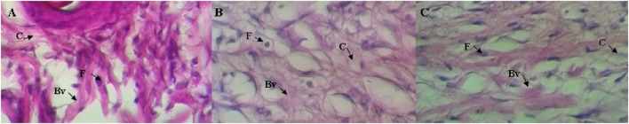Histological investigations of the burn wound healing effects of CSO (0.962 g/mL) on rat’s skin: (A) negative control, (B) SSD (0.01 g/mL) treated group, and (C) group treated with CSO (0.962 g/mL) on day 15. The labeled arrows identify collagen (C), fibroblast (F), and a blood vessel (Bv). Images were acquired at a magnification of 400×.