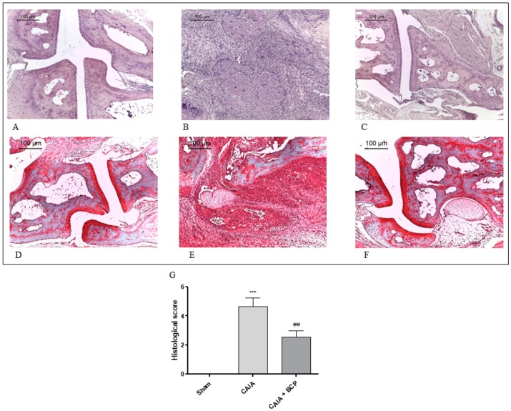 Representative H&E and Safranin O staining of joints from mice: Sham (A,D), CAIA (B,E) and CAIA + BCP (C,F). The graph (G) represents the histological score. Data are expressed as means ± SD. *** p < 0.0001 vs. Sham; ## p < 0.001 vs. CAIA.