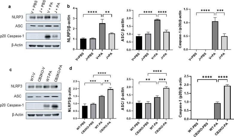 CB2R regulates NLRP3 inflammasome activation in PA pneumonia. C57BL/6 J WT mice received either vehicle (V) or JWH133 (J) and were exposed to PBS or PA. Lung NLRP3 inflammasome activation was assessed by measuring the protein levels of NLRP3, ASC, and (p20) caspase-1. Representative immunoblot images are shown in panel (a) and densitometry data are presented in panel (b). CB2KO and WT mice received JWH133 and were exposed to PBS or PA and the protein levels of NLRP3, ASC, and (p20) caspase-1 were analyzed by immunoblot. Representative immunoblot images are shown in panel (c) and densitometry data are presented in panel (d). n = 5, **p < 0.01***p < 0.001, ****p < 0.0001. Data are presented as mean ± SEM