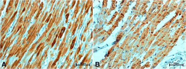 Immunolocalization of CB1 receptor in the heart of woman (a) under 50 years old; strong CB1-immunosignal in cardiomyocytes (b) over 50 years old; weak CB1 immunoreactivity in the cytoplasm of cardiomyocytes and very strong CB1-immunolabelling in ICDs