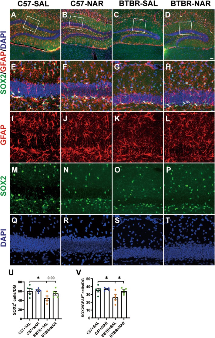 Naringin treatment rescues the pool of NPC in the DG of BTBR mice. (A–D) Representative images of SOX2+/GFAP+ double‐positive NPCs in the DG of four groups of mice. (E–T) High‐magnification image of the designated area. (U) Quantification of the number of SOX2+ cells in the DG. (V) Quantification of SOX2+/GFAP+ cells in the DG. The scale bar = 50 μm is shown in Figure D and applied to (A–D). The scale bar = 10 μm is shown in Figure T and applied to (E–T). Data are presented as mean ± SEM. N = 5. *p < 0.05.