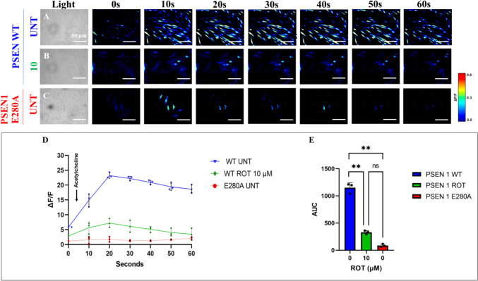 Rotenone (ROT) impairs acetylcholine (ACh)-induced transient Ca2+ influx in ChLNs. After 7 days of transdifferentiation, WT PSEN1 ChLNs were untreated or treated with ROT 10 μM and PSEN1 E280A ChLNs were left in regular culture medium (RCm) for 24 h. A–C Time-lapse images (0, 10, 20, 30, 40, 50, and 60 s) of Ca2+ fluorescence in A untreated WT PSEN1 or B treated with ROT and C E280A ChLNs in response to ACh treatment. ACh was added to the culture at 0 s (arrow), and Ca2+ fluorescence of cells was monitored at the indicated times. The color contrast indicates fluorescence intensity: dark blue < light blue < green < yellow < red. D Normalized mean fluorescence signal (∆F/F) over time from cells indicating temporally elevated cytoplasmic Ca2+ in response to ACh treatment; E Calculated area under the curve (AUC). Data are expressed as mean ± SD; Statistically significant differences when ** p < 0.01. The figures represent 1 out of 3 independent experiments. Image magnification, 200×