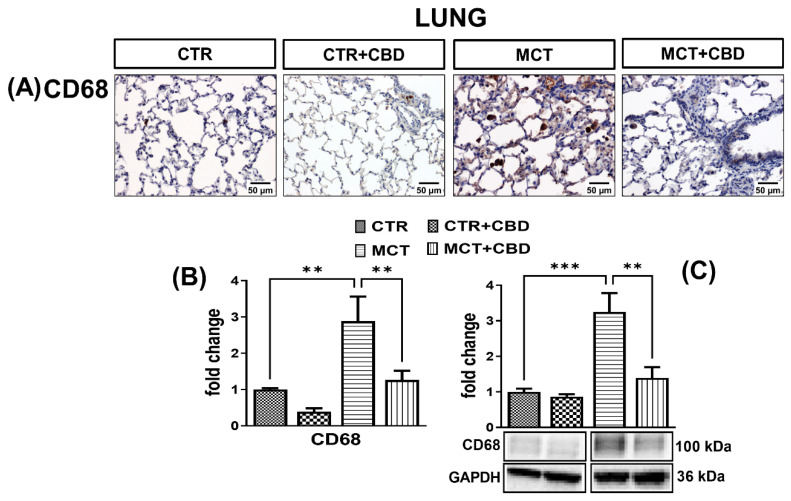 The influence of monocrotaline (MCT)-induced pulmonary hypertension and cannabidiol (CBD) or its vehicle on cluster of differentiation (CD68) (A); representative micrographs of immunohistochemical staining (magnification 200×) (B) and their quantification; and (C) the density of CD68 determined by Western blot in rats’ lungs. Bar graphs B and C illustrate the fold changes (for the relative fold change in expression in comparison to the respective CTR, whose expression level was set to 1) in the percentage area stained for CD68 and in the density of CD68, respectively. The dark brown precipitate represents the intensity of CD68. CBD (10 mg/kg) or its vehicle was injected i.p. every 24 h for 21 days. Data are presented as mean ± SEM, (n = 6–7 per group); ** p < 0.01, *** p < 0.001, compared to the respective group.