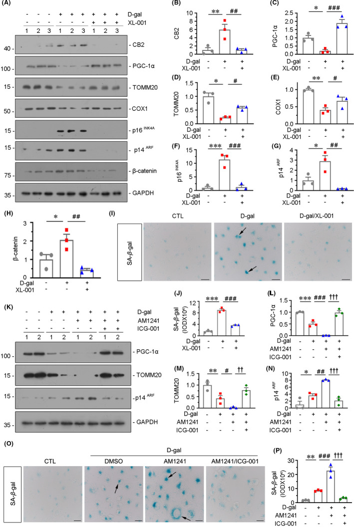 CB2 plays a central role in the accelerated ageing in renal tubular cells. (A–H) Representative Western blot and quantitative data showing the expression of CB2, PGC‐1α, TOMM20, COX1, p16INK4A, p14ARF and β‐catenin in HKC‐8 cells. HKC‐8 cells were treated with D‐gal at 10mg/ml for 72h and pretreated with XL‐001 (10μM) for 1 h. *p < 0.05, **p < 0.01, ***p < 0.001 versus the control group alone;# p < 0.05, ## p < 0.01, ### p < 0.001 versus the d‐gal group alone (n = 3). (I and J) Representative micrographs and quantitative data showing SA‐β‐gal activity in different groups. Frozen kidney sections were stained for SA‐β‐gal activity. Arrows indicate positive staining. Scale bar, 20 μm. ***p < 0.001 versus the control group alone; ### p < 0.001 versus the d‐gal group alone (n = 3). (K–N) Representative Western blot and quantitative data showing renal expression of PGC‐1α, TOMM20 and p14ARF in HKC‐8 cells. HKC‐8 cells were treated with D‐gal at 10mg/ml or cotreated with AM1241 (10 μM) for 72 h and pretreated with ICG‐001 (10 μM) for 1 h. *p < 0.05, **p < 0.01, ***p < 0.001 versus the control group alone; # p < 0.05, ## p < 0.01, ### p < 0.001 versus the d‐gal group alone; †† p < 0.01, ††† p < 0.001 versus the d‐gal+AM1241 group alone (n = 3). (O and P) Representative micrographs and quantitative data showing SA‐β‐gal activity in different groups. Frozen kidney sections were stained for SA‐β‐gal activity. Arrows indicate positive staining. Scale bar, 20 μm. **p < 0.01 versus the control group alone; ### p < 0.001 versus the d‐gal group alone; ††† p < 0.001 versus the d‐gal+AM1241 group alone (n = 3)