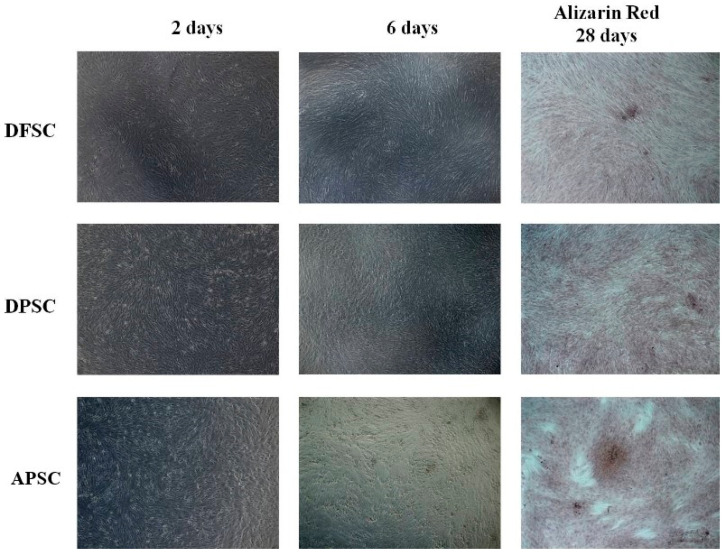 Osteogenic differentiation with osteoinductive medium. White light microscopy images of morphological changes induced by cultivation of cells with simple osteogenic medium (after 2 and 6 days). Alizarin red staining of differentiated cells after 28 days of cultivation.
