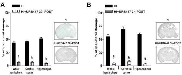 Evaluation of brain damage after neonatal hypoxia-ischemia (HI) and treatment with URB447. Infarct volume measured in the whole hemisphere, cerebral cortex, and hippocampus of 14-day-old rats subjected to HI on P7 and treated with (HI) or URB447 1 mg/kg 30 min after HI (HI+URB447 30 min-POST) (A), or URB447 1 mg/kg 3 h after HI (HI+URB447 3h-POST) (B). Images represent coronal brain sections at the hippocampal level of each experimental group stained with toluidine blue. Results are expressed as percentage of ipsilateral damage calculated from bilateral regional volumes using the formula 100(L – R)/L, where L is the volume of the contralateral region and R the volume of the ipsilateral region (N = 10/group). § P < 0.001, Mann–Whitney test.