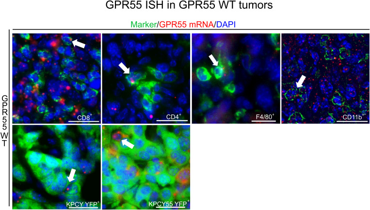 Presence of GPR55 in KPCY and KPCY55 tumors. ISH/immunofluorescence for immune and tumor cells in sections of KPCY and KPCY55 tumors from WT mice. Representative arrows point at cells expressing GPR55 mRNA signals (red). Antibodies against immune cell markers CD8+, CD4+, CD11b+, and F4/80+ were used (all in green). Tumor cells (YFP+) of KPCY and KPCY55 tumors were labeled with anti-GFP antibody (green). Nuclei were stained with DAPI (blue). Calibration bars=20 µm. 30-900 cells were counted per section; sections from 3 animals used. ISH, In situ hybridization; WT, wildtype; TME, tumor microenvironment.