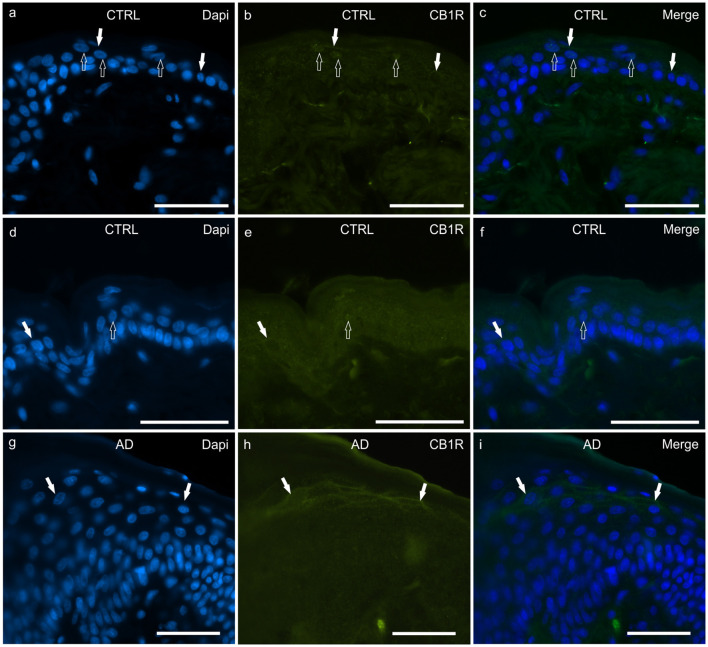 Photomicrographs of cryosections of canine skin showing cannabinoid receptor 1 (CB1R) immunoreactivity (IR) in the tissues of the healthy dogs (CTRL) (a–f) and in the dogs with atopic dermatitis (AD) (g–i). Two different anti-CB1R antibodies were used: (a–c) Rabbit anti CB1R (Orb10430) antibody; (d–f) Rabbit anti CB1R (ab23703) antibody. (a–f) The open arrows indicate DAPI-labeled nuclei of the epithelial cells which displayed faint CB1R-IR; the white arrows indicate faint CB1R-IR of the cell membrane of the keratinocytes. (g–i) In the AD-dogs, the keratinocytes of the upper layers (in proximity to the stratum corneum) showed moderate CB1R-IR of their cell membranes (white arrows). (g–i) were obtained using the Orb10430 antibody. Bar, 50μm.