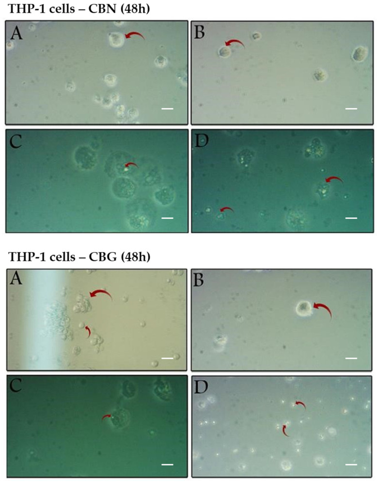 Effect of CBG or CBN treatment on THP-1 cell morphological characteristics. THP-1 cells were treated with CBN (upper panel) or CBG (lower panel) for 48 h at concentrations of 0 µM (A), 1 µM (B), 50 µM (C), and 100 µM (D). The red arrows mark changes in morphological characteristics in THP-1 cells in comparison with the control 0 µM (A). Representative fields were imaged at 200× magnification. Scale bar = 25 µm.