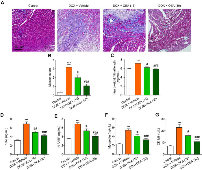 OEA alleviates DIC in mice. Mice with or without DOX (6 mg/kg, i. v.) challenge were treated with OEA (15 or 30 mg/kg, i. v.) for 14 days concurrently with DOX challenge. Heart tissues were isolated at day 15 for analysis. Representative histopathological sections of heart tissues by (A) Masson’s trichrome staining. (B) Myocardial fibrosis in the areas as described in (A) were graded. The effects of OEA or its vehicle on (C) heart weight/ tibial length ratio, serum levels of (D) cTNI (E) H-FABP (F) myoglobin and (G) CK-MB in mice. Data are expressed as mean ± SEM, n = 6. ***, p < 0.001 vs. control. #, p < 0.05; ##, p < 0.01; ###, p < 0.001 vs. DOX + vehicle.