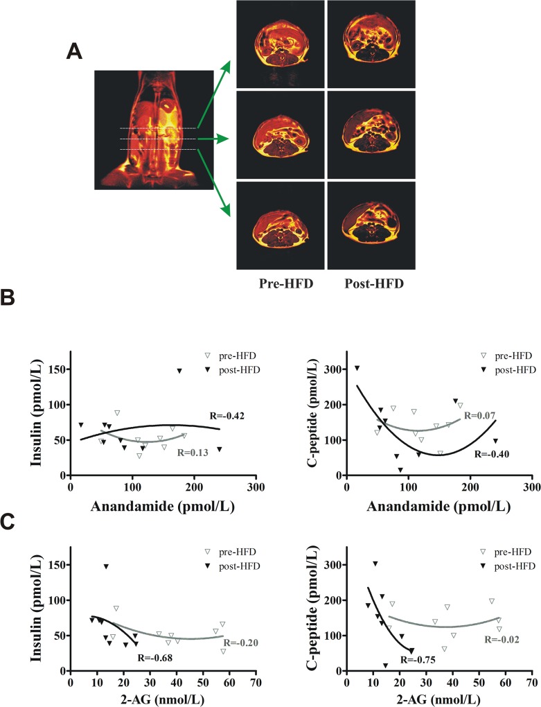 Metabolic changes in dogs maintained on a hypercaloric high-fat diet for 22 weeks.(A) Magnetic resonance scanning shows a substantial increase of fat content in the abdominal region after prolonged fat feeding. (B) Relationship between fasting plasma anandamide and insulin or C-peptide (C) Relationship between fasting plasma 2-AG and insulin or C-peptide. Association was determined using Spearman correlation. Lines represent non-linear (second-order polynomial) fit of the plots.