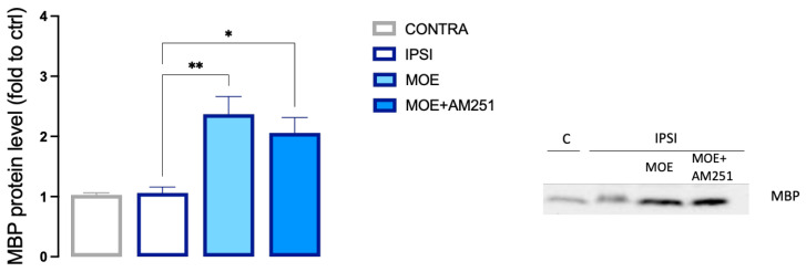 MOE-induced increase of MBP content in the spinal cord of SNI mice. Lack of effect by AM251 treatment. MBP values were obtained by Western blot analysis. Representative blots are reported. * p < 0.05, ** p < 0.01.