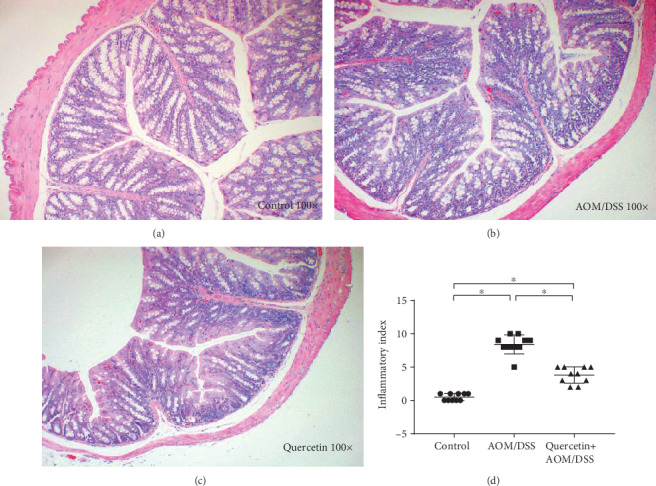 Quercetin reduces inflammation in AOM/DSS-treated mice. (a) H&E staining figure in the control group. (b) H&E staining figure in the AOM/DSS group. (c) H&E staining figure in the quercetin+AOM/DSS group. (d) Inflammatory index of the three groups. ∗P < 0.05, Student's t-test, data representative of three independent experiments presented as mean values ± SD (n = 10/group).
