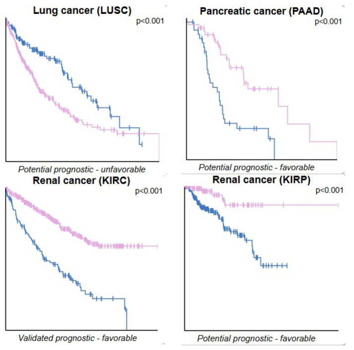 PINK1 as a prognostic marker in other types of cancer. Kaplan–Meier plots illustrate the survival outcomes for various cancers where high PINK1 expression levels show a statistically significant correlation (p < 0.001) with patient survival. The prognosis—whether favorable or unfavorable—is noted in brackets alongside each plot. Survival analysis: Kaplan–Meier plots summarize results from analysis of correlations between mRNA expression levels and patient survival. Patients were divided, based on expression levels, into one of the two following groups: “low” (under cut-off) or “high” (over cut-off). The x-axis shows the time for survival (years), and the y-axis shows the probability of survival, where 1.0 corresponds to 100 percent. The blue line indicates low PINK1 expression, and the lilac line indicates high PINK1 expression.