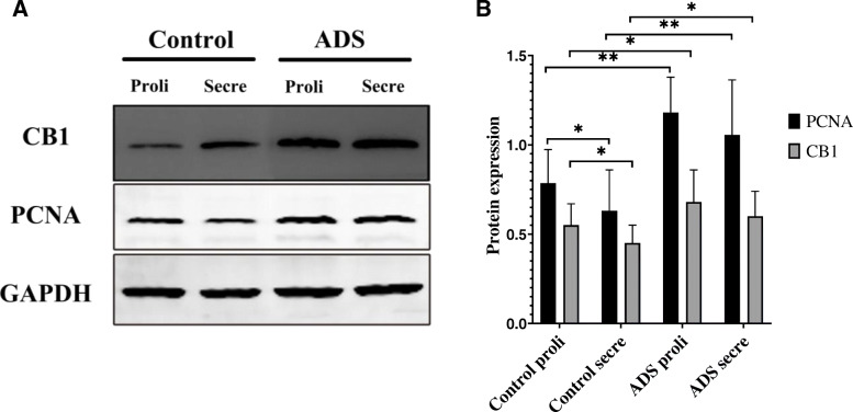 CB1 and PCNA mRNA expression in JZSMCs from control and adenomyotic women in the proliferative phase (Proli) and secretory phase (Secre). Three independent experiments were conducted for each treatment. One representative image from each group of three experiments is shown. The error bars on all histograms indicate the standard deviation. *, P < 0.05; **, P < 0.01