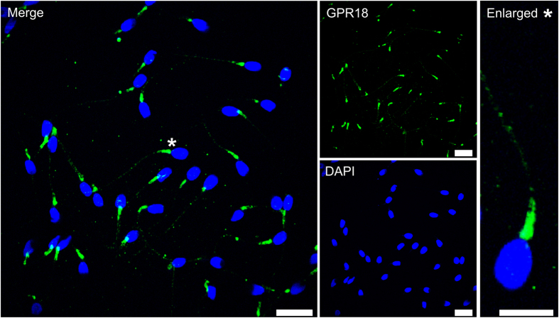 GPR18 protein is localized to the midpiece of human spermatozoa.Immunocytochemical staining of human spermatozoa with an α-GPR18 antibody (green). DAPI staining (blue) was used to determine the number and location of spermatozoa. Scale bars: 10 μm. Enlarged: *indicated the zoomed section. Scale bar: 5 μm.