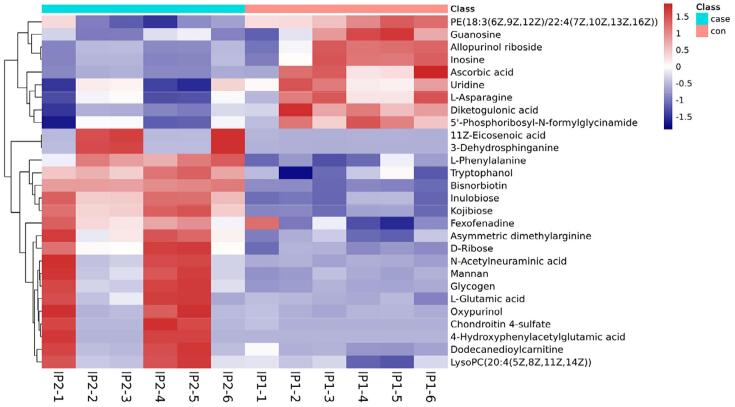 Heat map of differentially expressed metabolites: IP1-1–IP1-6, control groups; IP2-1–IP2-6, pulpitis group. Blue and red color intensity indicates the abundance of metabolites from low to high.