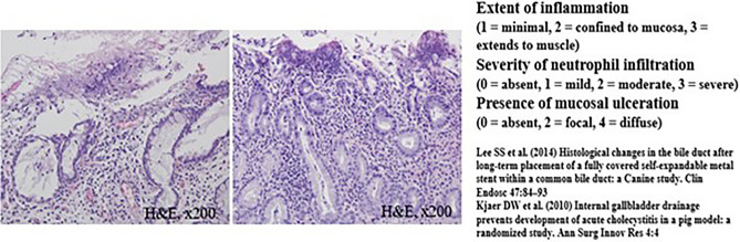 Comparison of microscopic images of bile duct inflammation using histologic scoring system between 3-month (left) and 5-month (right) follow-up animal models.