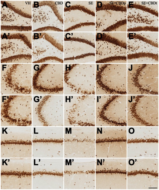 Representative micrographs from contralateral (A–O) and ipsilateral (A’–O’) hilus (A–E,A’–E’), CA3 (F–J,F’–J’), and CA1 (K–O,K’–O’) of VH (A,A’,F,F’,K,K’), CBD (B,B’,G,G’,L,L’), SE (C,C’,H,H’,M,M’), SE+CBDp (D,D’,I,I’,N,N’), and SE+CBDt (E,E’,J,J’,O,O’) rats 3 days after SE, submitted to NeuN immunohistochemistry. See the intense neuron loss throughout the hippocampal subfields of a SE rat, both ipsilateral and contralateral to pilocarpine injection, compared to VH and CBD controls. The neuroprotective effect of CBD on SE-induced neuron loss is visible in the SE+CBD groups, as statistically confirmed in Figure 8. HIL, hilus; IPSI, ipsilateral side to pilocarpine injection; CONTRA, contralateral side to pilocarpine injection. The bar in O’ indicates 100 μm.