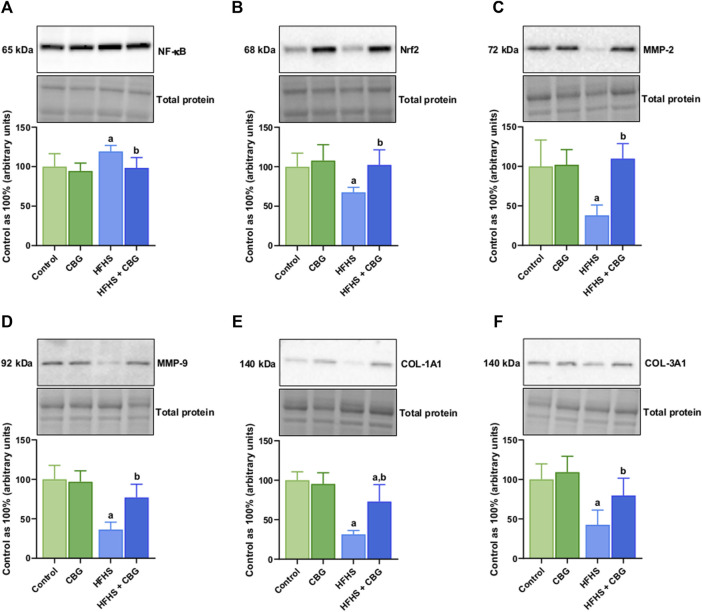 The total intramuscular expression of proteins involved in the inflammatory pathway, i.e., nuclear factor kappa B (NF-κB) (A), nuclear factor erythroid 2-related factor 2 (Nrf2) (B), matrix metalloproteinases 2 and 9 (MMP-2 and MMP-9) (C,D) as well as collagen type I, alpha 1 and collagen type III, alpha 1 (COL-1A1 and COL-3A1) (E,F) in the control group (rats fed a standard chow) and high-fat-high-sucrose diet (HFHS) group after 2-week cannabigerol (CBG) administration in the red gastrocnemius muscle. The total expressions of the abovementioned proteins are presented as percentage differences compared to the control group which was set as 100%. The data are expressed as mean values ±SD and are based on six independent determinations in each group (n = 6); ap < 0.05 indicates a significant difference: the control group vs the examined group; bp < 0.05 indicates a significant difference: HFHS group vs HFHS + CBG group.