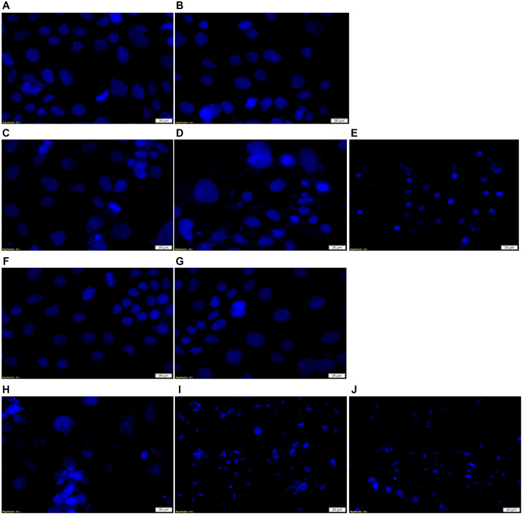 DNA damage Hoechst 33258 stained in vitro CRC cells examination in FNBC PDT response assays with and without CBD treatment.(A) Cells only, (B) Cells + Irradiation (10 J/cm2), (C) Cells + 0.125 μM ZnPcS4 + Irradiation, (D) Cells + 0.125 μM ZnPcS4 – AuNP-PEG5000-SH- NH2 + Irradiation, (E) Cells + 0.125 μM ZnPcS4 – AuNP-PEG5000-SH- NH2 – Anti-GCC Ab + Irradiation, (F) Cells + 1 uM CBD + Irradiation, (G) Cells + Ethanol, (H) Cells + 0.125 μM ZnPcS4 + 1 uM CBD + Irradiation, (I) Cells + 0.125 μM ZnPcS4 – AuNP-PEG5000-SH- NH2 + 1 uM CBD + Irradiation and (J) Cells + 0.125 μM ZnPcS4 – AuNP-PEG5000-SH- NH2 – Anti-GCC Ab + 1 uM CBD + Irradiation.