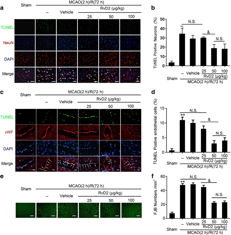 RvD2 exerted rescue effects on MCAO/R-induced neuron and BMVEC death. Apoptotic cell death was detected by terminal deoxynucleotidyl transferase dUTP nick end labeling (TUNEL) staining. Sections were labeled by TUNEL (green) to detect apoptotic neurons (red) (a) and brain microvascular endothelial cells (BMVECs) (red) (c) and counterstained with DAPI (blue) to detect nuclei. Arrows point to TUNEL-positive cells. The percentage of TUNEL-positive brain cells was calculated (b and d). Scale bar = 64 μm (A) and 24 μm (c). Data are expressed as mean ± SEM, n = 6. **P < 0.01 vs. sham group, &P < 0.05, N.S. = no significant differences. e Fluoro-Jade B (FJB) staining was used to detect necrosis. Scale bar = 64 μm. The number of FJB-positive brain cells was calculated (f). Data are expressed as mean ± SEM, n = 6. **P < 0.01 vs. sham group, &P < 0.05, N.S. = no significant differences
