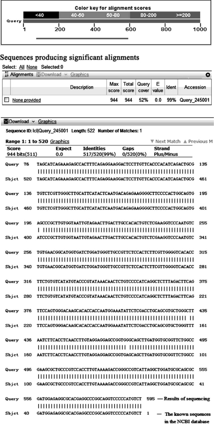 Verification of CNRIP1 overexpression in colon cancer cells. BLAST comparative analysis of the CNRIP1-transfected clone sequence data was conducted with the sequences listed in the database curated by the National Center for Biotechnology Information (NCBI). Sequences were consistent with one another, thereby indicating that the CNRIP1 CDS was successfully cloned via our PCDNA3.0 vector