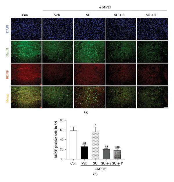 Effects of CB1 antagonist or PPARγ inhibitor treatment on the SUEHP‐mediated recovery of BDNF expression in the substantia nigra of the MPTP‐induced PD animal model. (a) Expression of BDNF, a neuroprotective factor, in the substantia nigra of the MPTP‐induced PD mouse model following SUEHP treatment at GB34 acupoint in the presence of CB1 antagonist (SR141716A) or PPARγ inhibitor (T0070907) cotreatment was determined using immunofluorescence staining. (b) The number of BDNF‐positive cells was quantified using ImageJ. Data are presented as the mean ± SEM (n = 4). aa p < 0.01, aaa p < 0.001 vs. Con. b p < 0.05 vs. MPTP‐Veh. Scale bar = 100 μm. Abbreviations: BDNF, brain‐derived neurotrophic factor; DAPI, 4′,6‐diamidino‐2‐phenylindole; MPTP, 1‐methyl‐4‐phenyl‐1,2,3,6‐tetrahydropyridine; NeuN, neuronal nuclei; PD, Parkinson’s disease; SEM, standard error of the mean; SN, substantia nigra; SUEHP, SU‐Eohyeol pharmacopuncture. Experimental groups: Con, saline control + saline injection at GB34; MPTP‐Veh, MPTP + saline injection at GB34; MPTP‐SU, MPTP + SUEHP injection at GB34; MPTP‐SU + S, MPTP + SUEHP injection at GB35 with SR141716A pretreatment; MPTP‐SU + T, MPTP + SUEHP injection at GB34 with T0070907 pretreatment.