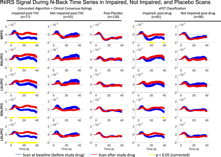 HbO response at pre- and post-dose by consensus rating (columns 1 and 2), placebo (column 3) and eFSR rating (columns 4 and 5).The time course of mean HbO changes (µM) in each ROI are plotted in those who received THC and were impaired (Col 1), received THC and were unimpaired (Col 2), received placebo THC (Col 3), received an impaired rating from an eFST (Col 4), and in those who received a not-impaired rating from an eFST (Col 5). Pre-dose HbO response is shown in blue, and peak dose (Scan 2 or 3, whichever had the higher intoxication rating) is shown in red. Blue and red lines represent the mean and the standard error of the mean in each group. Yellow lines represent single timepoints in which the group differences between pre and peak HbO were significant (using a paired t-test with Benjamini-Hochberg FDR correction and p < 0.05). For statistical purposes, only matched pre and post-dose scans were included, which resulted in a sample size of 77 (out of 80) concordant impaired subjects and 55 (out of 57) concordant not clearly impaired subjects. MPFC middle prefrontal cortex, RDLPFC right dorsolateral prefrontal, RVLPFC right ventrolateral prefrontal cortex, LDLPFC left dorsolateral prefrontal cortex, and LVLPFC left ventrolateral prefrontal cortex.