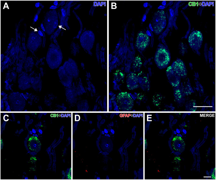 Details of CB1- and GFAP-immunolabeling in the spiral cochlear ganglion of the GASH/Sal. (A,B) Low magnification confocal microscopy images show spiral ganglion neurons stained with DAPI (in blue) and CB1-immunolabeling (in green) in the spiral cochlear ganglion. Note that the perikaryon of the spiral ganglion neuron is enveloped by satellite cells (arrows). (C–E) High magnification confocal microscopy images show CB1-immunolabeling in the cell body of a spiral ganglion neuron. Weak GFAP-immunolabeling was observed in the spiral cochlear ganglion. Scale bars = 20 μm in (A,B); 10 μm in (C–E).