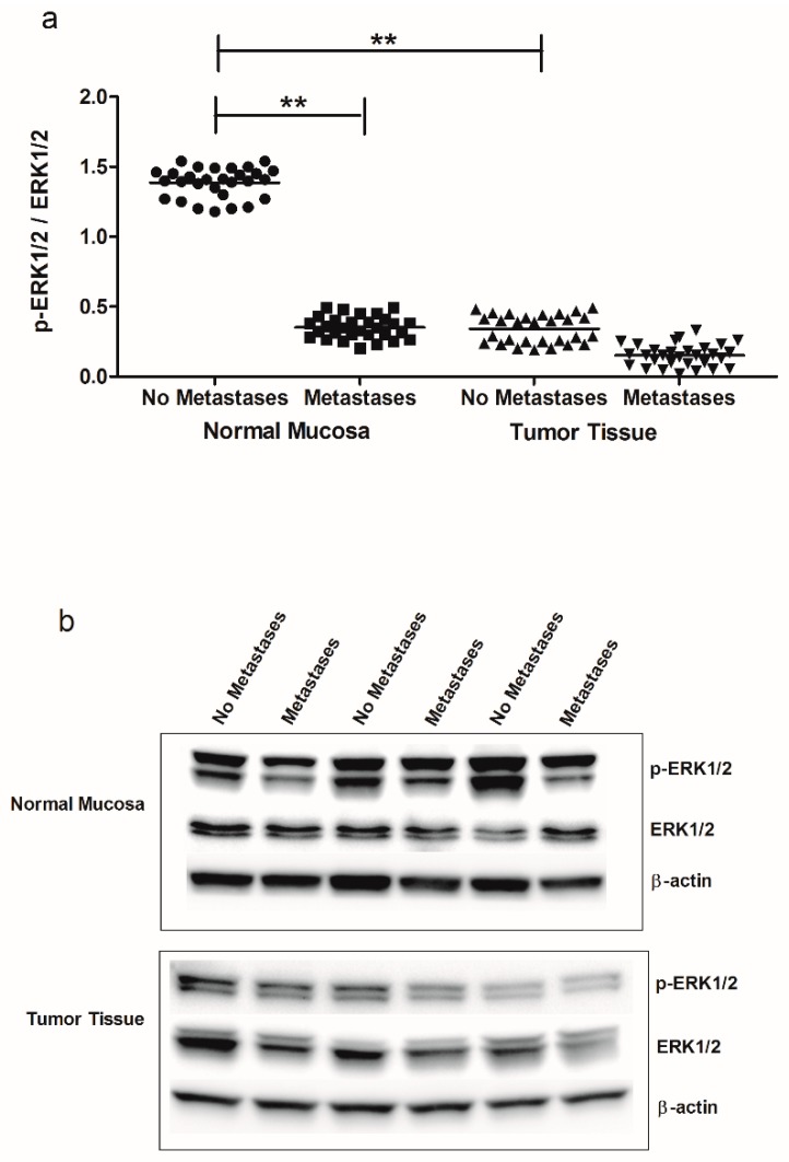 (a) p-ERK1/2/ERK1/2 ratio protein values detected in intestinal tissue of no metastases (n = 29 patients) and with metastases patients (n = 30 patients), in both normal mucosa and tumor tissue. ** p < 0.02 indicates statistically significant differences (one-way analysis of variance and Tukey’s multiple comparison test). (b) Representative Western blot bands of p-ERK1/2, ERK1/2 and β-actin proteins.