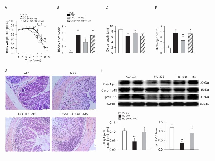 3-MA attenuates the protective effect of HU 308 on DSS-induced colitis in mice and the inhibitory of HU 308 on NLRP3 inflammasome activation in colon from DSS-induced colitis mice.C57BL/6 mice were treated with 3% DSS, DSS + HU 308 (1 mg/kg, i.p.) or DSS + HU 308 (1 mg/kg, i.p.) + 3-MA (10 mg/kg, i.p.) daily for 8 days. The control mice were given tap water. 3-MA significantly inhibited the beneficial effect of HU 308 on body weight loss (A), bloody stool score (B), colon length (C) and colon inflammation (D-E). n = 10 per group. **P<0.01 vs. the control group; #P<0.05 vs. the DSS group, ##P<0.01 vs. the DSS group; &P<0.05 vs. the DSS+HU 308 group, &&P<0.01 vs. the DSS+HU 308 group. (F) 3-MA also attenuated the inhibitory effect of HU 308 on Casp-1 p20/Casp-1 p45 ratio and proIL-1β in colon. n = 6 per group. **P<0.01 vs. vehicle; #P<0.05 vs. HU 308 group.