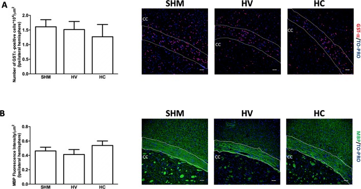 Quantification of mature oligodendrocyte population and myelin staining in white matter. Representative microphotographs and graphical representation of immunohistochemical studies performed in the external capsula of the corpus callosum 30 days after a hypoxic-ischemic (HI) insult induced in P7–10 Wistar rats then receiving vehicle (HV) or cannabidiol (HC), or a similar period in control rats (SHM). (A) GST-π (mature oligodendrocyte) and (B) myelin basic protein (MBP) staining. Bars represent mean ± SEM. Scale bar: 50 μm.