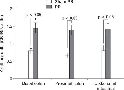 Expression of cannabinoid type 1 receptor (CB1R) in distal colon, proximal colon and distal small intestine following repeated partial restraint stress (PR). Levels of mRNA for CB1R measured by reverse-transcription polymerase chain reaction (RT-PCR). We observed a significantly higher level of CB1R mRNA in samples from chronic PR stress rats compared with control. Data are expressed as the relative CB1R PCR product to that of the housekeeping gene β-actin, mean ± SEM, n = 8 in each group.