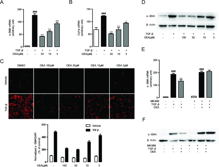 OEA suppressed TGF-β1 induced HSCs activation in vitro via PPAR-αA.-B. CFSC cells were treated with OEA (30 μM, 10 μM, 3 μM) followed by TGF-β1 (5 ng/mL) for 48 h, mRNA expression levels of α-SMA (A) and Col1a (B) were analyzed by real-time PCR. C.-D. Immunofluorescence staining (C) and western blot (D) were performed to detect protein expression levels of α-SMA. E.-F. CFSC cells were treated with OEA (10 μM) followed by TGF-β1 (5 ng/mL) for 48 h with or without MK886 (10 μM) treatment. The α-SMA mRNA expression levels were measured by real-time PCR (E). Protein expression levels of α-SMA were assessed by Western Blot (F). Data are shown as means ± s.e.m. of three independent experiments each performed in duplicate. ### P < 0.001, * P < 0.05, *** P < 0.001.