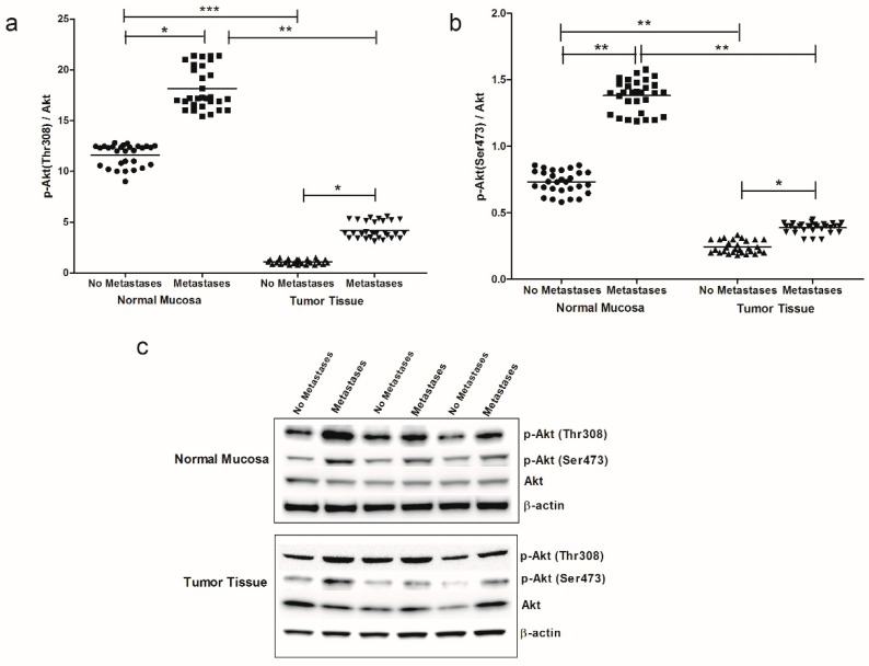 (a) p-Akt (Thr308)/Akt ratio protein values, detected in intestinal tissue of no metastases (n = 29 patients) and with metastases patients (n = 30 patients), in both normal mucosa and tumor tissue. (b) p-Akt (Ser473)/Akt ratio protein values detected in intestinal tissue of no metastases (n = 29 patients) and with metastases patients (n = 30 patients), in both normal mucosa and tumor tissue. * p < 0.05, ** p < 0.02, *** p < 0.001 indicate significant differences (one-way analysis of variance and Tukey’s multiple comparison test). (c) Representative Western blot bands of p-Akt (Thr308), p-Akt (Ser473), Akt and β-actin proteins.