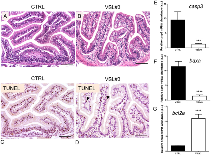 (A) Paraphysiological morphology of intestinal wall in untreated control zebrafish (bar = 200 µm). (B) Morphology of intestine of VSL#3-treated zebrafish reveals good integrity of the gut mucosa, without any inflammatory infiltrate or reactive status to probiotics (bar = 200 µm). (C) In section of gut of untreated fish, a high apoptotic rate evidenced by TUNEL is evident among epithelial and mesenchymal cells, with nuclear intense black stain (bar = 200 µm). (D) TUNEL analysis of section of VSL#3-treated intestine revealed that some enterocytes and mesenchymal cells are going into apoptosis, showing their nuclei intensively black stained by the chromogen (arrow heads, bar = 200 µm). Intestinal (E) casp3, (F) baxa and (G) bcl2a mRNA levels by qPCR normalized against act1b and rplp, in control and VSL#3-treated fish. Values indicate mean ± SD. ***p < 0.001 ****p < 0.0001.