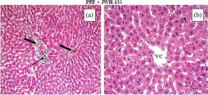 Representative histopathological findings in the PFE + JWH‐133 group (PJG). Little vascular congestion (thick black arrows) (a), mononuclear cell infiltration (thin black arrows) (a), and sinusoidal dilatation (b) was observed in this group. Haematoxylin and eosin staining, magnification ×20 (a) and ×40 (b). VC, vena centralis.