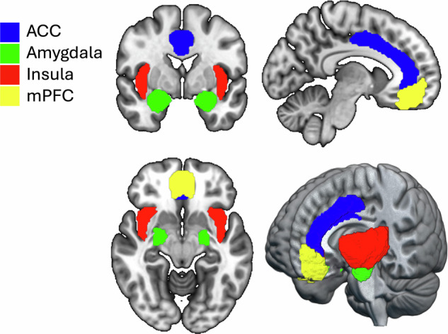 Emotional processing is governed by brain regions including the extended amygdala, insula, ACC, and mPFC.Abbreviations: ACC anterior cingulate cortex, mPFC medial prefrontal cortex. Image created with MRIcroGL [https://www.nitrc.org/projects/mricrogl].