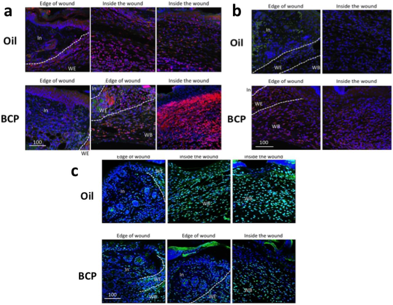 IL-1β, TNFα in the skin at the wound bed and close to the wound, and TUNEL staining of the skin at the wound bed and close to the wound.(a) IL-1β (red and purple) expression in the BCP and Oil group. Blue color as well as purple color is Draq 5+ cells. Green is autofluorescence. (b) TNFα expression (red and purple) expression in the BCP and Oil group. Blue color as well as purple color is Draq 5+ cells. Green is autofluorescence. (c) TUNEL staining with double staining with Draq 5. Green and light blue is TUNEL+ cells. Blue and light blue is Draq5+ cells. Scale bars are μm.