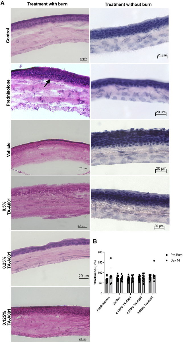 (A) H&E sections of alkali burned mouse corneas after 14 days post-treatment with TA-A001 compared to the drug vehicle and prednisolone. The arrow shows the change in thickness in the prednisolone-treated group compared to the others. Scale bars, 20 µm. (B) Thickness of corneas before and after alkali burn treatment as measured by optical coherence tomography.